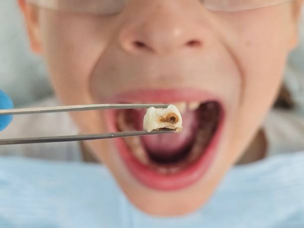 Best Emergency Treatment for Toothache in Catalina, AZ